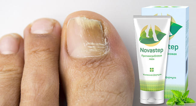Novastep от грибка стопы купить